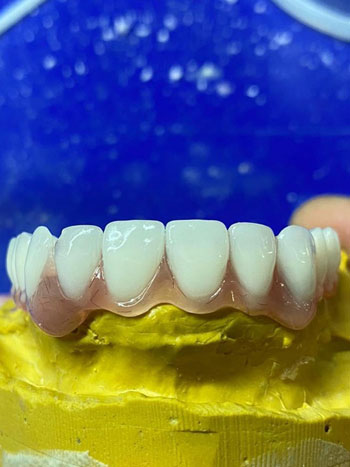 hareketli protez Sea Dental İzmir